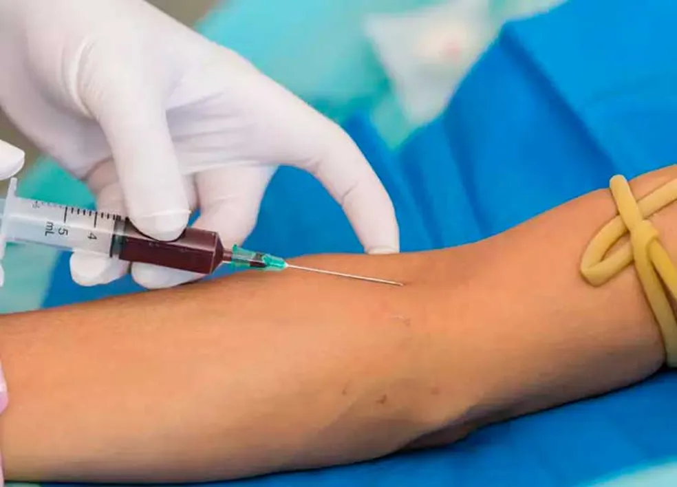 Exame PSA é feito com base na coleta de sangue de pacientes - Foto: Prefeitura de Assis/Divulgação